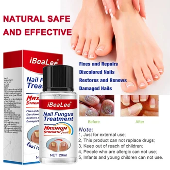 iBeaLee Лечение на Гъбички на Ноктите 7 ДНИ Лечебното Копър Серум Грижа За Ръце Нокти Крем За Премахване на Гъбички на Краката противоинфекционный Онихомикоза